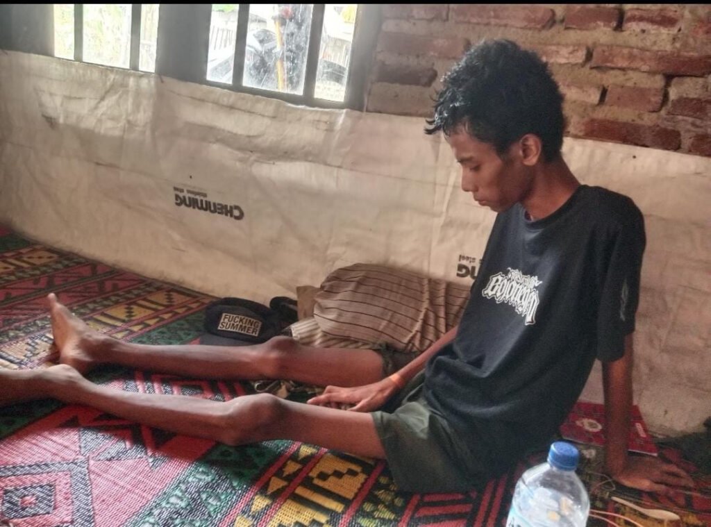 Remaja Yatim Piatu di Gunung Kaler Butuh Bantuan untuk Berobat